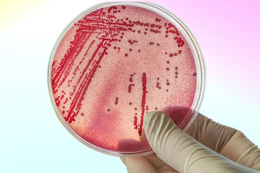Nước sinh hoạt nhiễm Coliform: Tác hại và cách xử lý